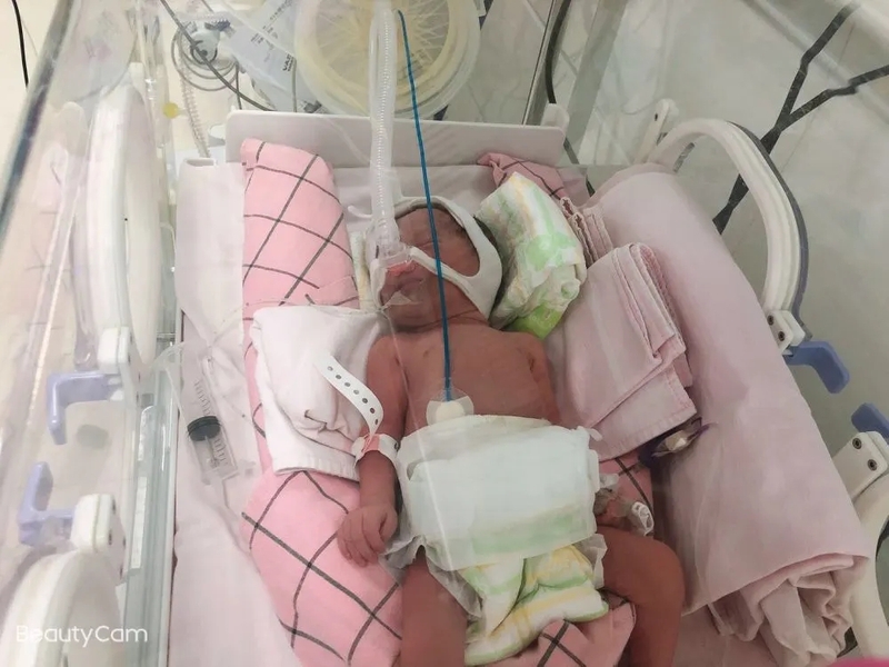 新生儿重症监护室守护生命的奇迹